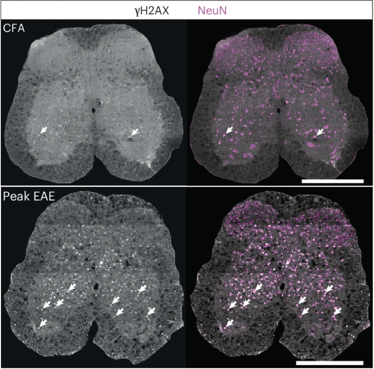 Autoimmune neuroinflammation leads to neuronal death via MIF nuclease-mediated parthanatos